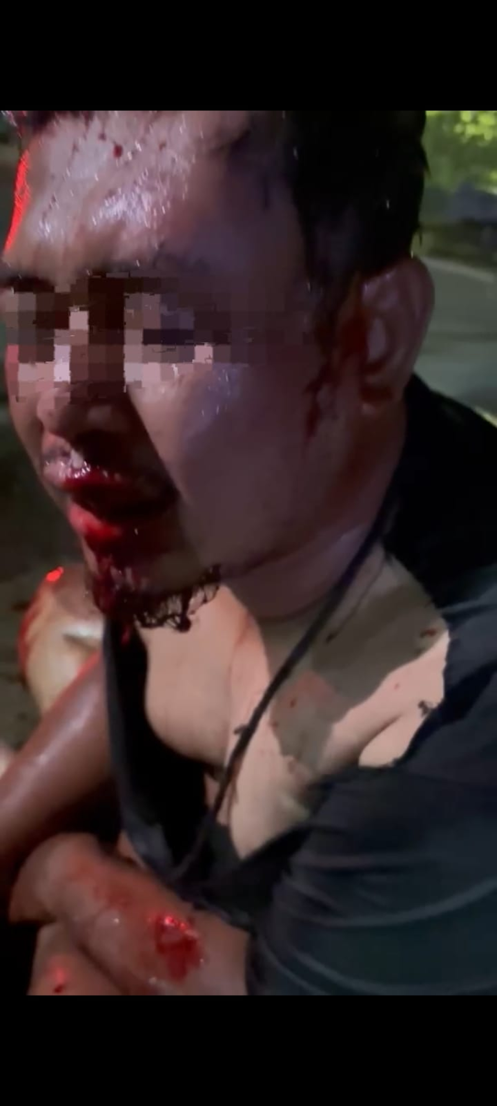 Kuasa Hukum Korban Pengeroyokan di Tol Pedot Ketapang Desak Polsek Tanggulangin Bergerak Cepat amankan Para Pelaku,"Jang